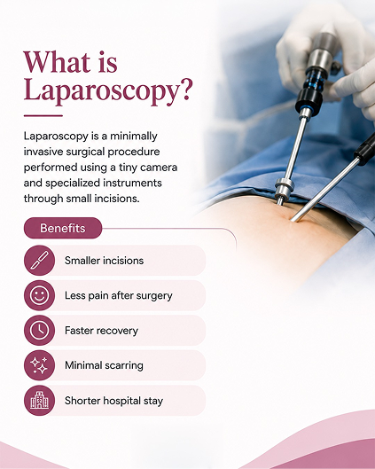 what is laparoscopy